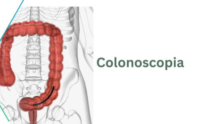 Colonoscopias